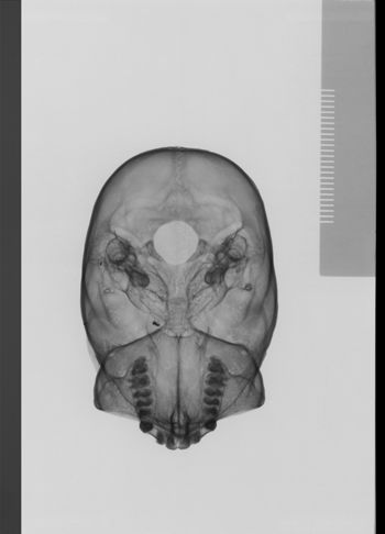 Media type: image;   Mammalogy 30568 Description: sagittal;